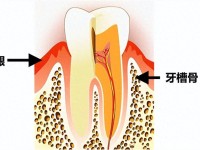 关注牙龈出血和牙齿松动，预防牙周疾病2023