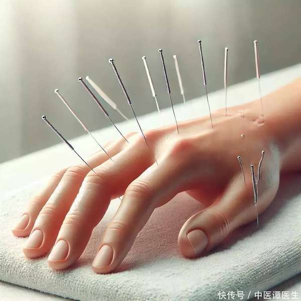 有什么可以治疗失眠(有一种失眠，针灸或能帮你调理，长期睡不好的人要知道)