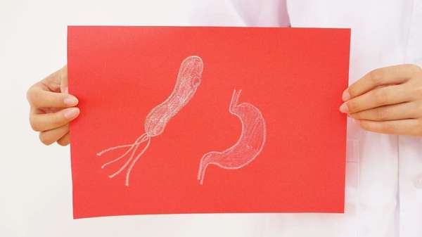 为什么胃息肉切除后一年又复发了(为何胃息肉切除了还会复发？医生：多半与4个因素有关，需警惕)