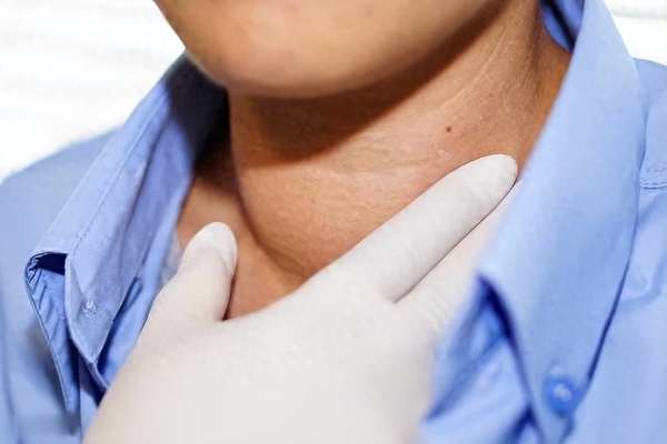 医生发现自己得甲状腺结节(医生发现：甲状腺有结节的人，可能有这4个身体表现！)