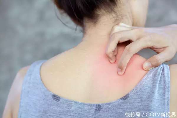 背中间酸胀心脏猝死(背痒一周后猝死？医生叹息：身上4个部位痒，可能致命，别大意了)