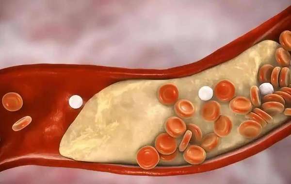 60岁以后胆固醇不能超过多少(60岁后胆固醇不超此范围，别乱吃药害自己)
