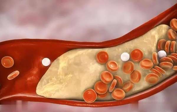 鲫鱼再成焦点！医生提醒胆固醇高者吃鲫鱼留意7点