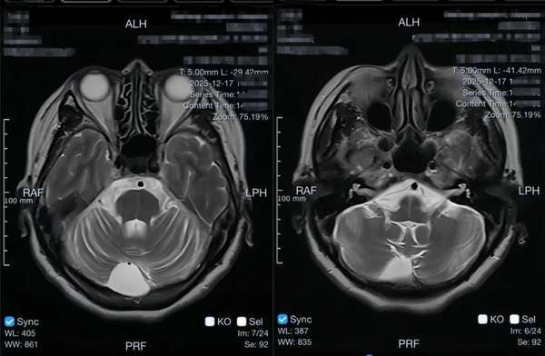 注意身体出现这9种信号要小心了(注意！身体多个部位接连出问题，可能是“多系统萎缩”)
