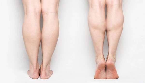 防血栓锻炼(防血栓、控血糖、助睡眠4个正确踮脚姿势让全身血液“活”起来)