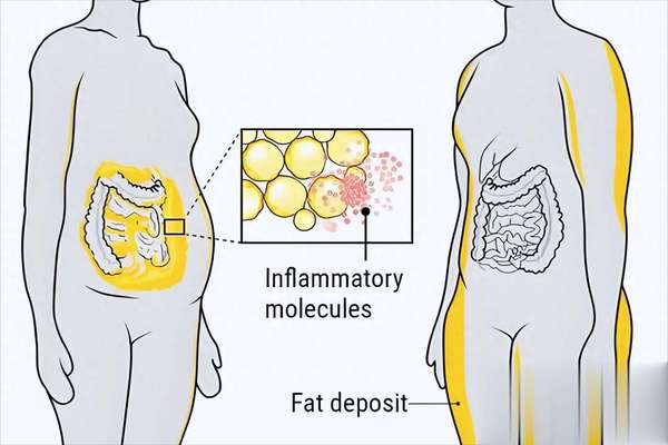 内脏脂肪杀手！4个燃脂行为让腰围暴降5-8cm