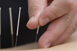 实验证明针灸镇痛有科学依据，针灸到底科学吗？